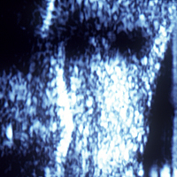 ultrasound portrait