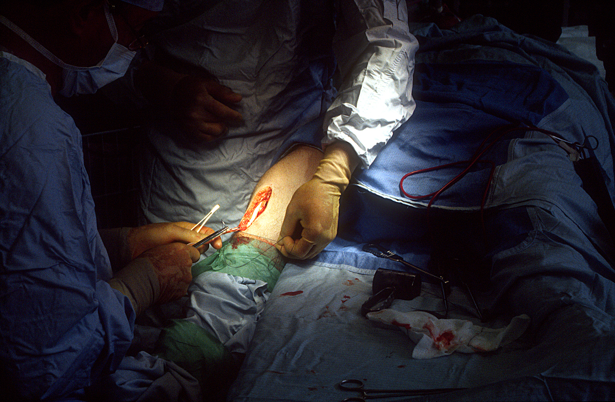 knee operation